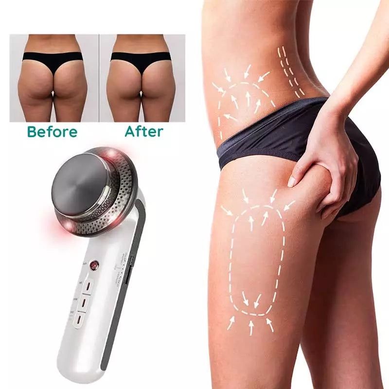 Ultrasonic Fat & Cellulite Burner
