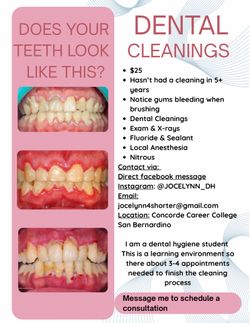 Free Dental Cleanings