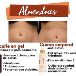 Gel Para Las Estrias✨