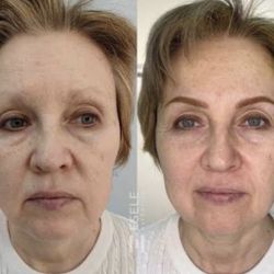 Brows  Natural 