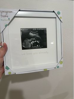Ultrasound frame