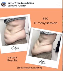 Body Sculpting Special | First Session $45