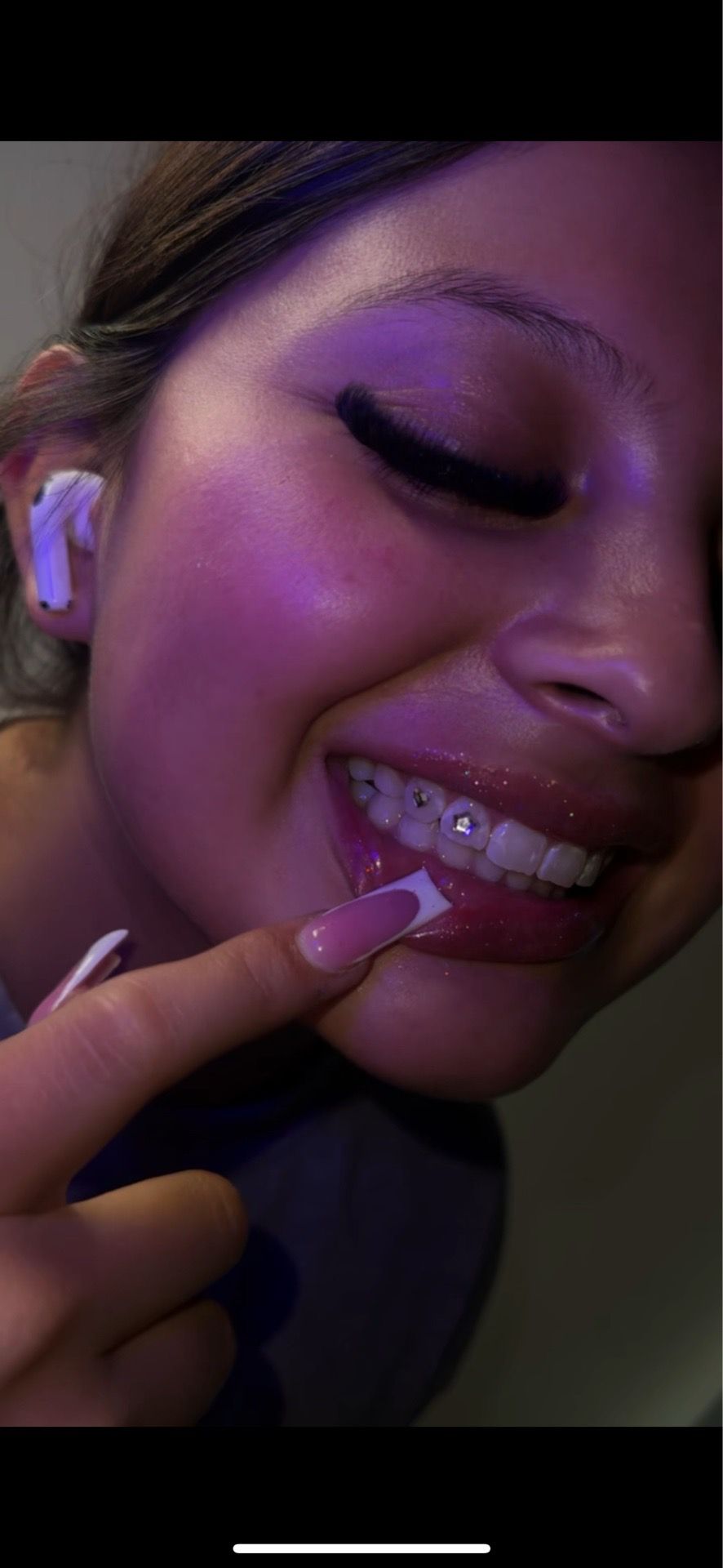 toothgem’s 😍