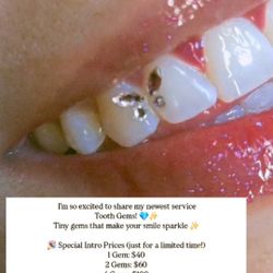 Tooth Gems 💎 