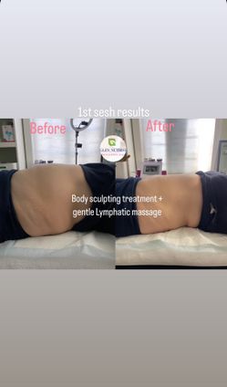 Body Sculpting