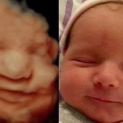 Ultrasonido/ultrasound