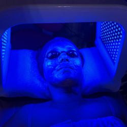 Faciales Luz Y Dermapen