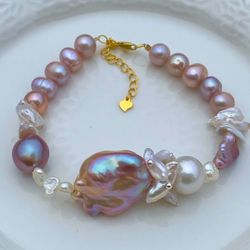 B54-Handmade flameball, Keshi And Edison Pearl S925 Bracelet