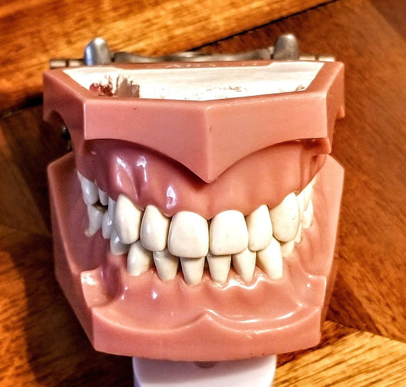 Model full denture.