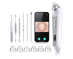 A Blackhead Remover 