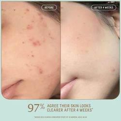 Biossance Mini Gel Moisturizer 