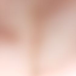 ISO Quick Weight Loss coach