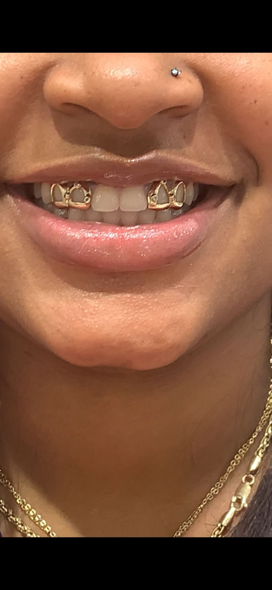 10k Gold Grills
