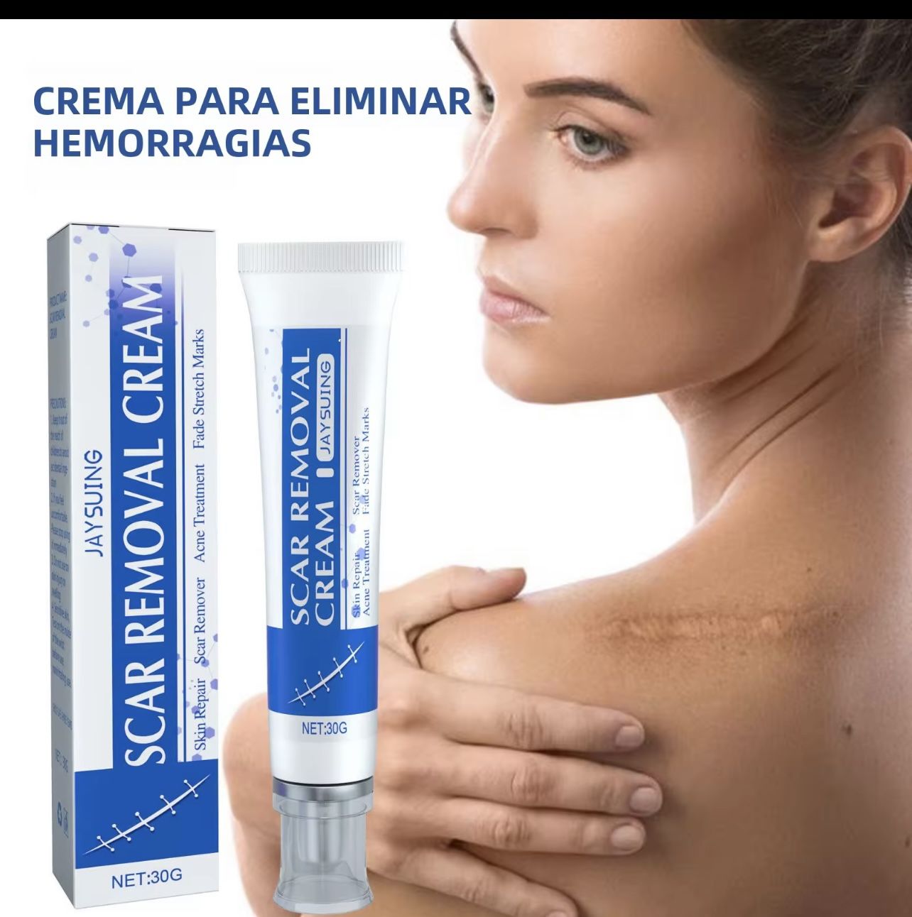 Scar Removal Cream
