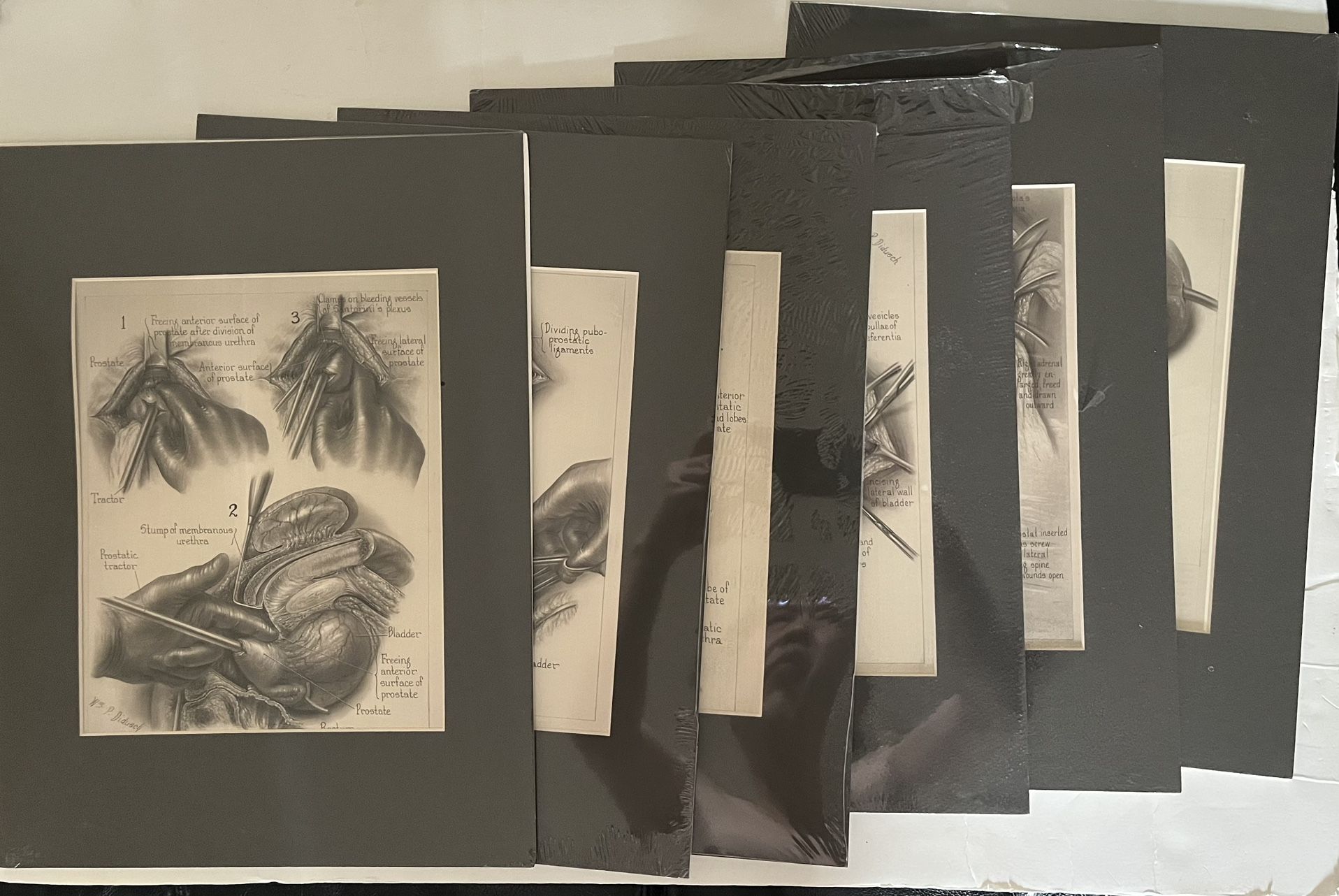 New Boehringer Ingelheim Inc Prints Medical Anatomy Urology Lot of 6 By Didusch