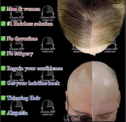 Hair