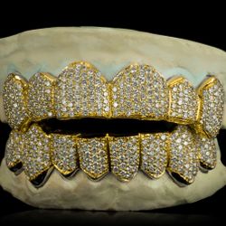 Diamond & Gold & Silver Custom Grillz 