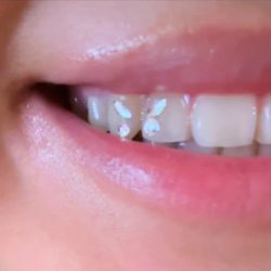 Teeth Gems 