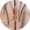 Lousey Day Lice Removal 