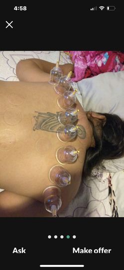 Massage Cupping And More 
