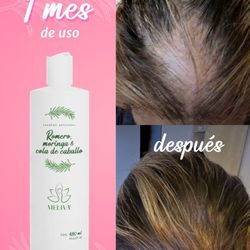 Shampoo De Romero Anti Caida