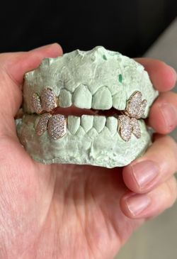 CUSTOM GRILLZ FOR TEETH GRILLS GOLD SILVER DIAMONDS LAB DIAMONDS