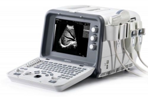 Edan D6 Ultrasonic Diagnostic Imaging System