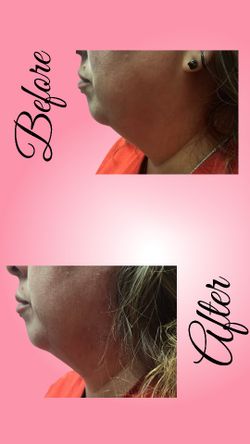 Bodyscupting