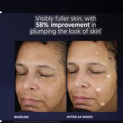 PCA Skin Medical Grade Skin Care Duo Anti Agin Medical Grade Skin Care 