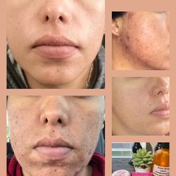 Skin Care