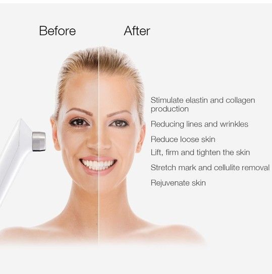 Avorla RF Radio Frequency Facial And Body Skin Tightening Machine