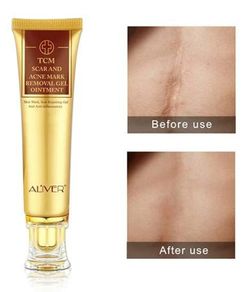 Scar Removal Cream