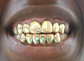 Custom Jewelry Gold teeth, rings, watches, pendents